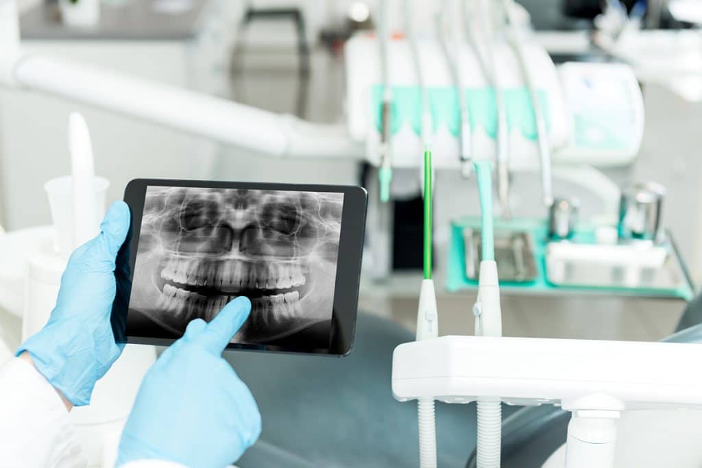 Digital Dentistry: Revolutionizing Your Dental Experience