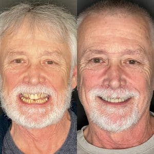 Redefining Health and Confidence With a Smile Transformation